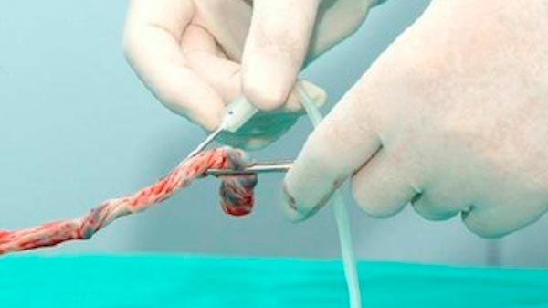 Lagomaggiore: Extraen sangre de cordones umbilicales para donarla al Banco Público del Garrahan