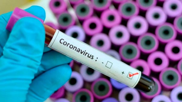 Primer caso confirmado de coronavirus en Mendoza