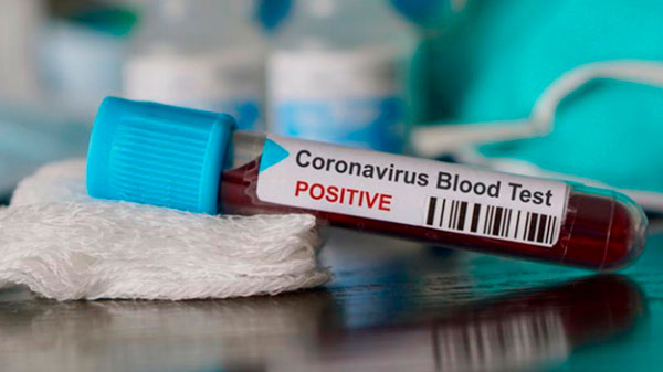 Confirman un nuevo caso de coronavirus en Mendoza