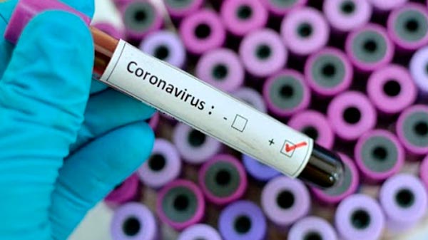 Confirmaron 8 nuevos casos de coronavirus en General Alvear