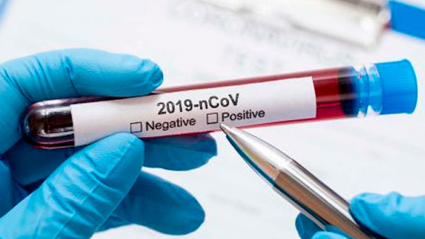 Con otros dos nuevos casos, Mendoza suma 14 personas con coronavirus