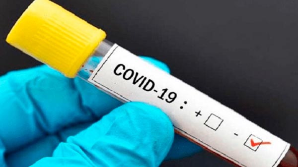Alvear: Finalmente el hombre de 58 años no tiene Coronavirus
