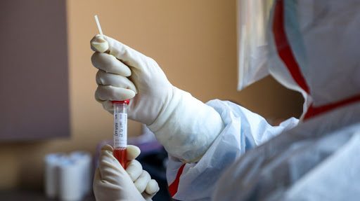 Otro coronavirus positivo: Mendoza suma 70 personas afectadas