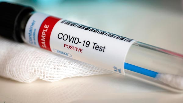 COVID-19: domingo con 15 nuevos positivos y 3 pacientes recuperados en el Sur