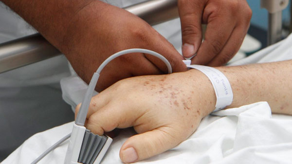 Para evitar «confusiones» en los hospitales, Mendoza identificará con una pulsera a cada paciente