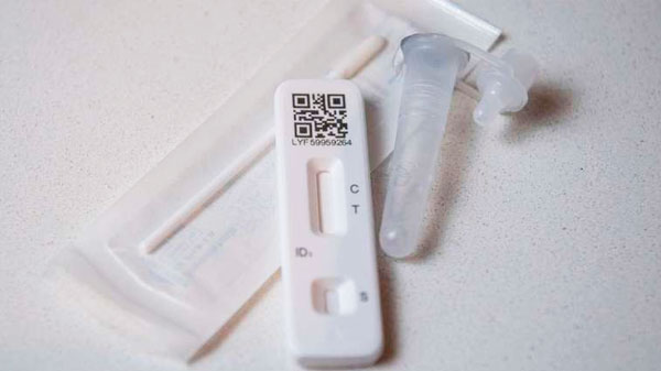 Los autotest para detectar coronavirus se venderán en farmacias