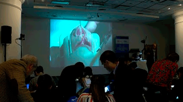 El Garrahan es el primer hospital del país con un simulador 3D para cirugía de labio palatina