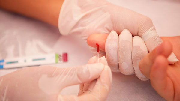 Por el Día Internacional de la Prueba de VIH, se realizarán testeos confidenciales y gratuitos