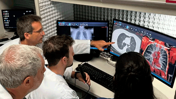 Impulsan la teleradiología para la detección temprana del cáncer de pulmón en regiones remotas del país