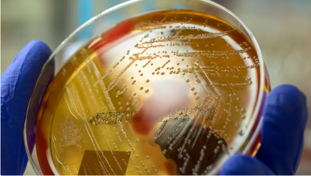 Los detalles de la enfermedad bacteriana que se extiende en Japón y pone en alerta a los expertos